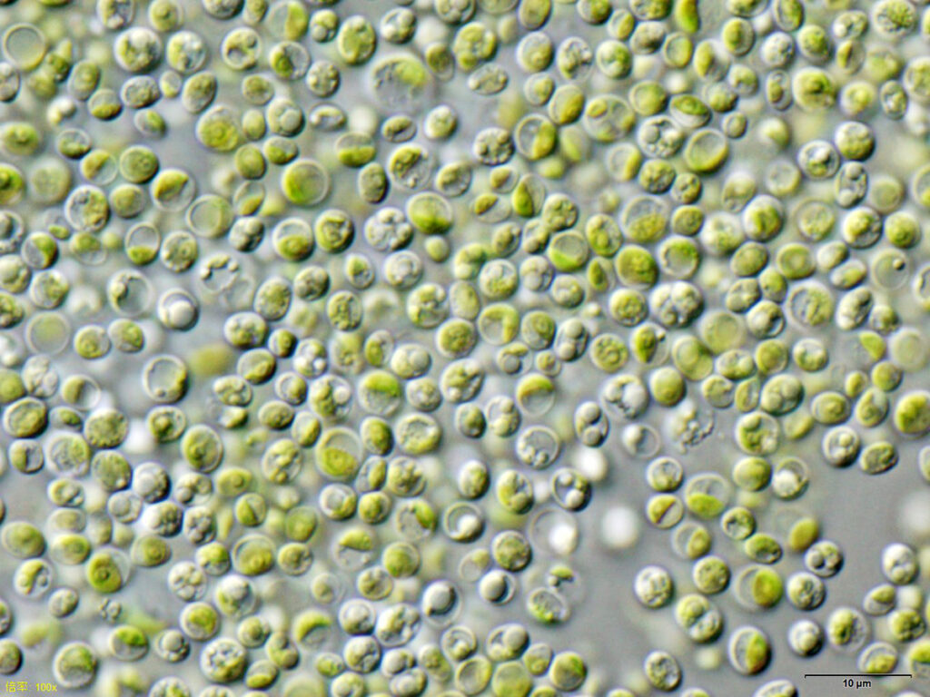 Chlorella vulgaris cells under a microscope, small round green algae