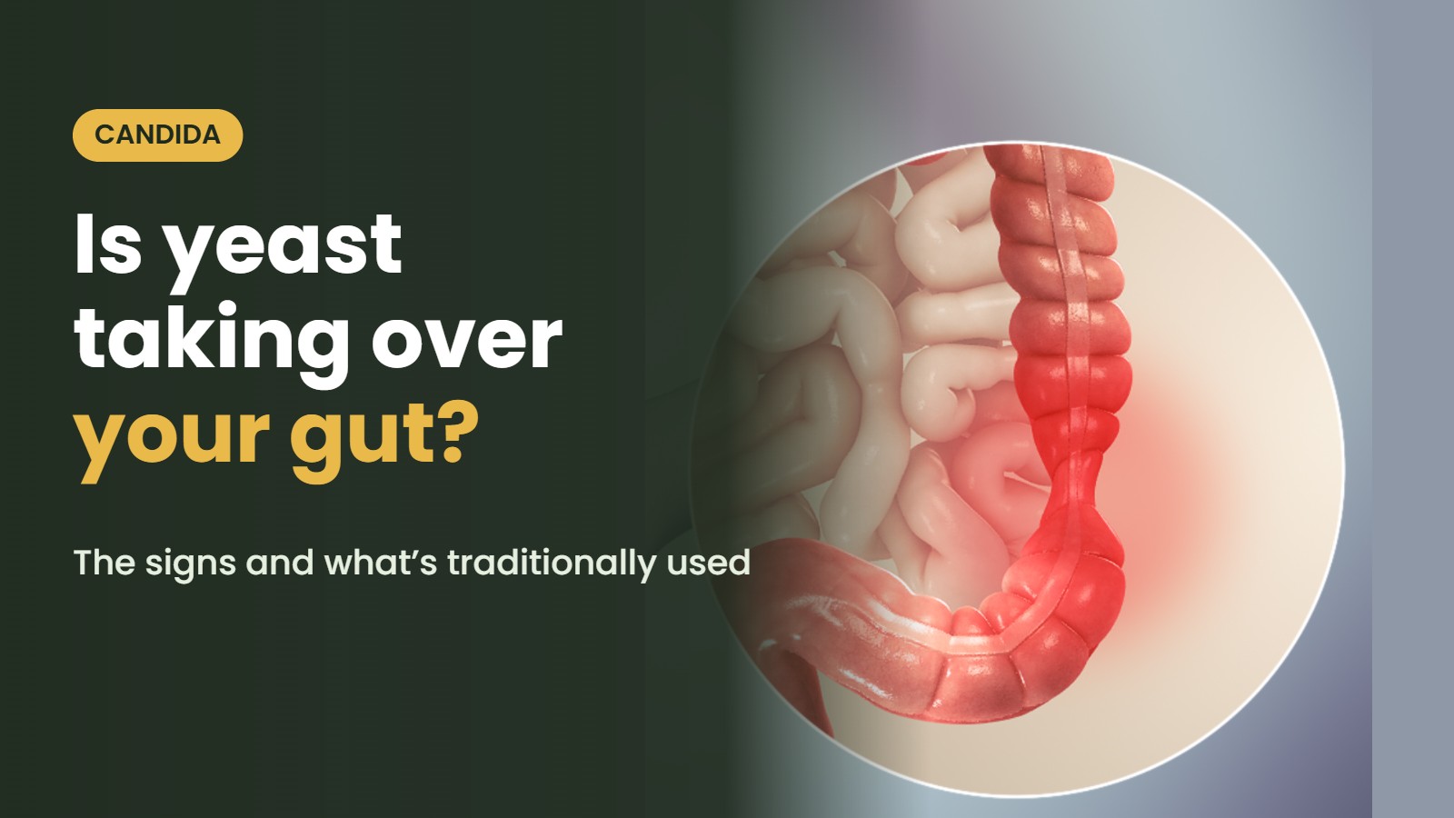 Illustration of the intestines with the headline: Is yeast taking over your gut? The signs and what’s traditionally used