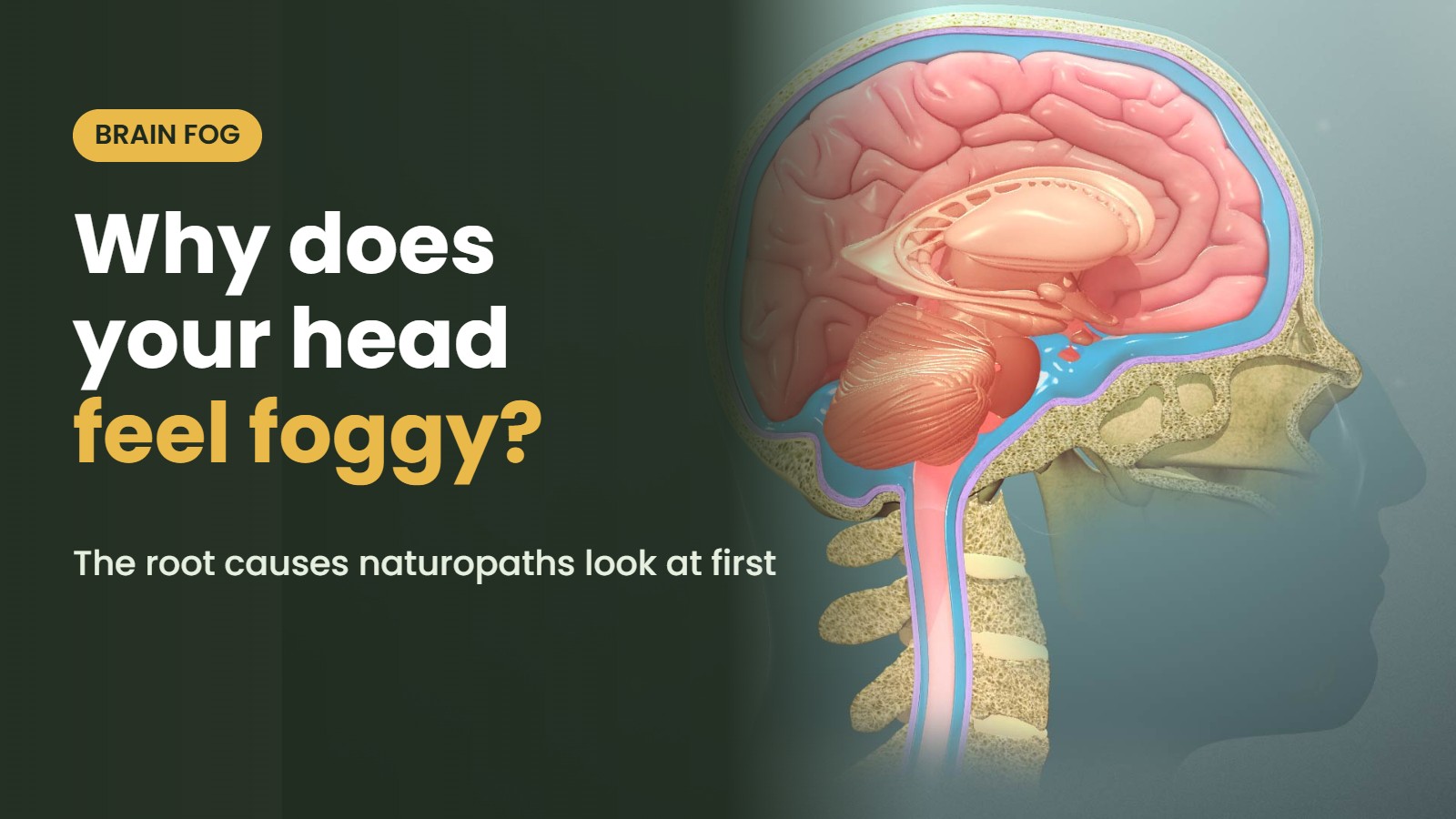 Illustration of the brain and nervous system with the headline: Why does your head feel foggy? The root causes naturopaths look at first